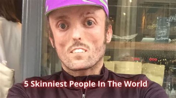 5 Skinniest People in the World