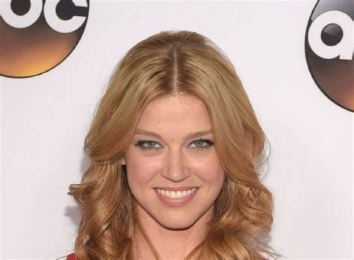 Adrianne Palicki Plastic Surgery Before and After