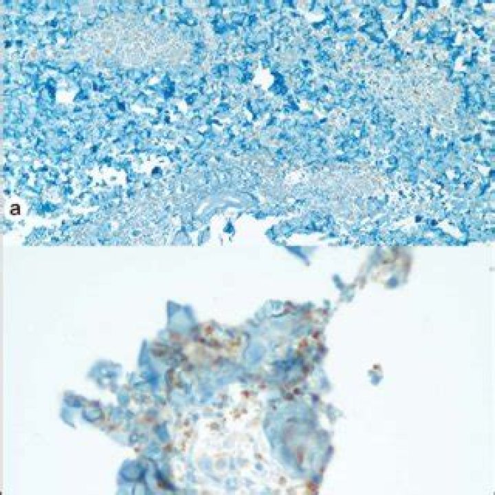 Dr. Alan Menter, MD – Dallas, TX