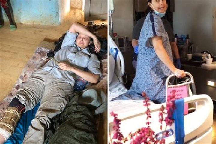 Ashley Judd face accident