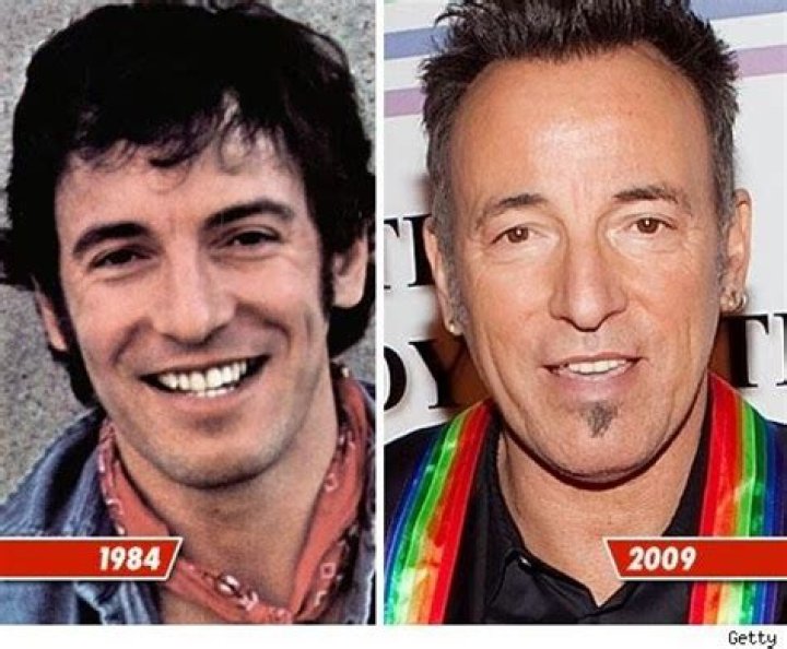 Bruce Springsteen Plastic Surgery: Result of Plastic Surgery and Controversy Exposed