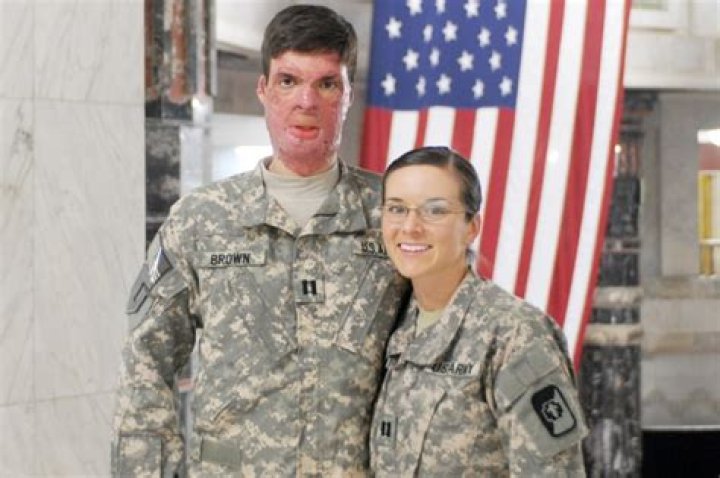 Captain Sam Brown Wikipedia – Wife Amy Brown, Before And After Photos – US Army Veteran