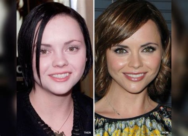 Christina Ricci Plastic Surgery Before and After