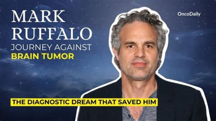 Did Mark Ruffalo have a brain tumor? – Celebrity