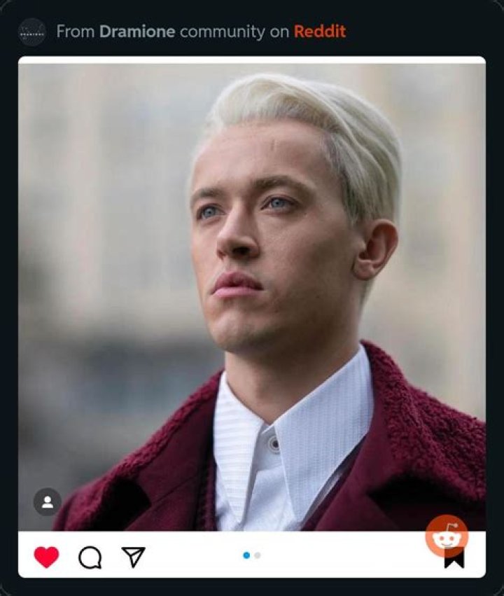 Did they bleach Tom Felton’s hair? Was Tom Felton’s hair real in Harry Potter?