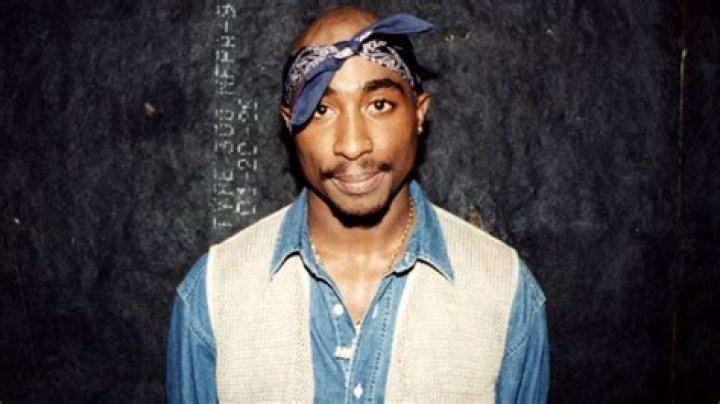 Did Tupac Shakur have alopecia?