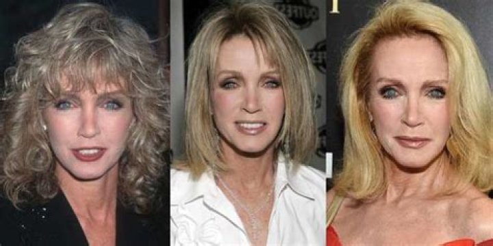 Donna Mills Plastic Surgery: Her Mind Blowing Beauty Hacks or Undergoing Artificial Procedures?