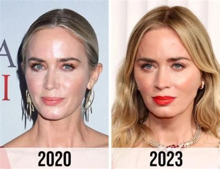 Emily Blunt Plastic Surgery: Unrevealing The Truth Behind Her Beauty