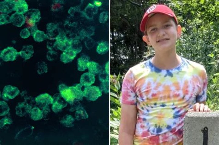 Florida boy battling brain eating amoeba after swimming