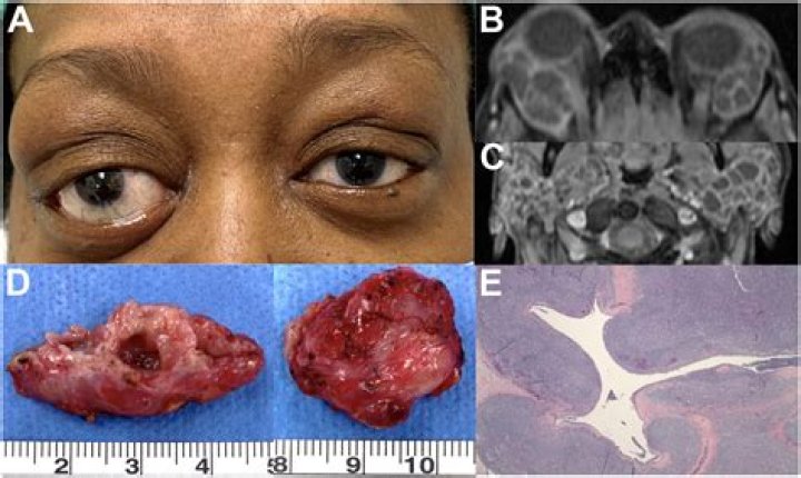 Dr. Gerschon Suster, MD – Carrollton, TX