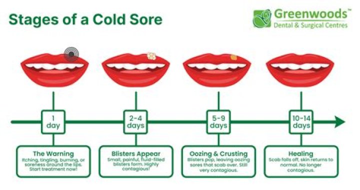 How did Hilly get the cold sore? – Celebrity