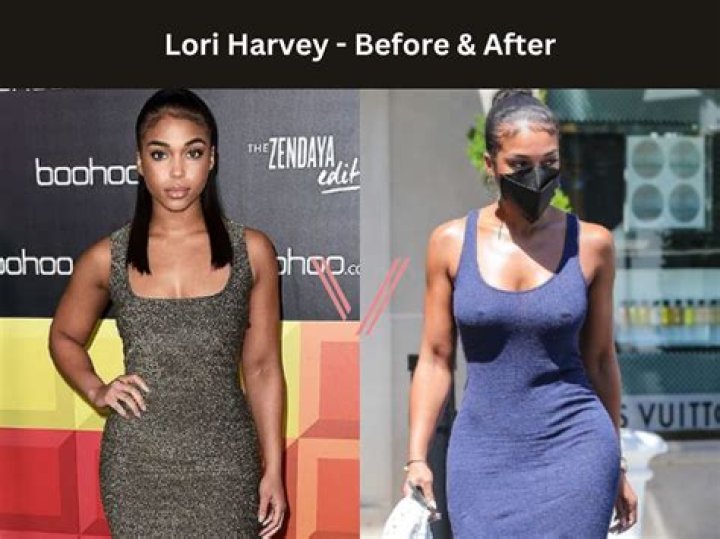 Is Lori Harvey Related To Steve Harvey? Plastic Surgery Before And After Photos Explored