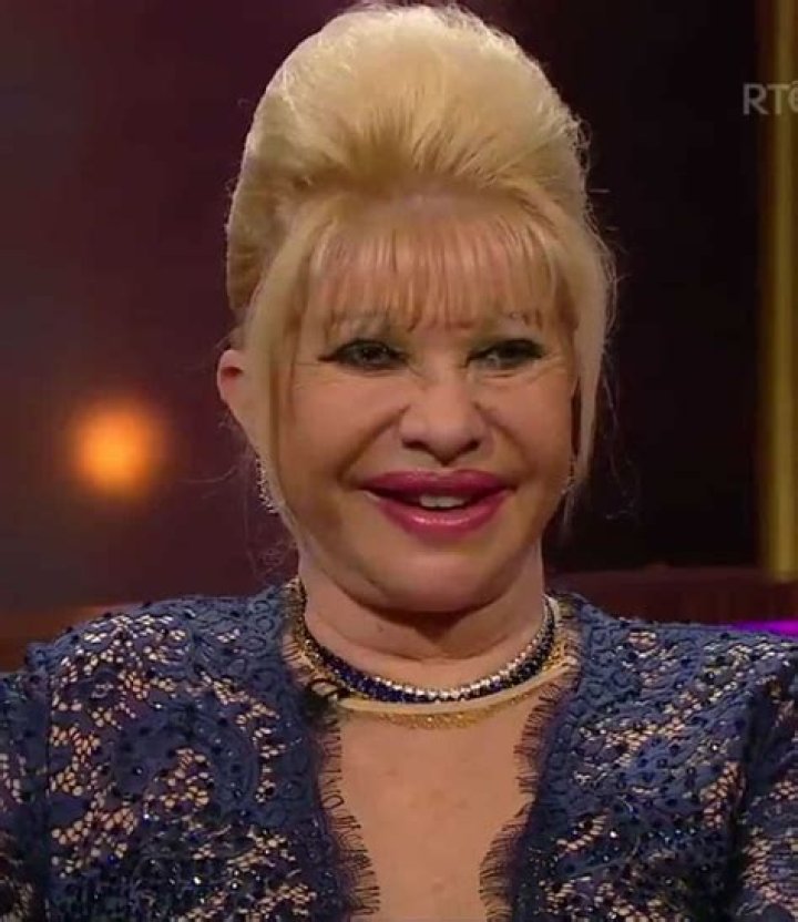 Ivana Trump Plastic Surgery: Before and After