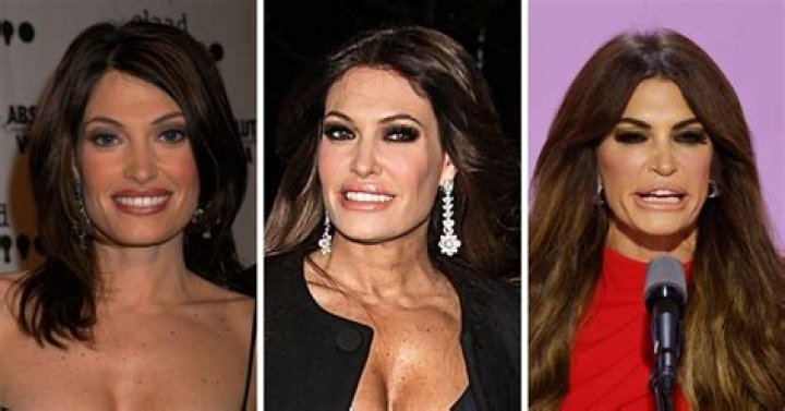 Kimberly Guilfoyle Plastic Surgery: Facelift, Botox, and the Quest for Timeless Beauty