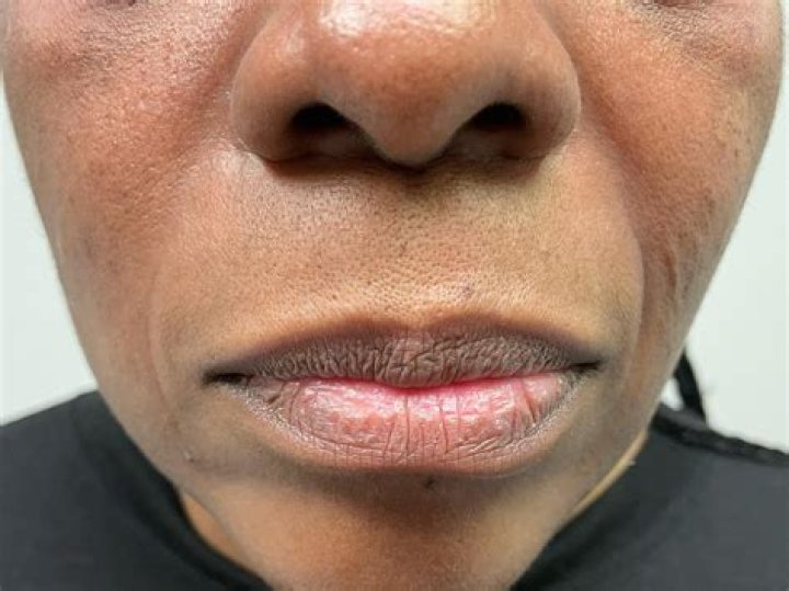 Dr. Klara Briskin, MD – New York, NY