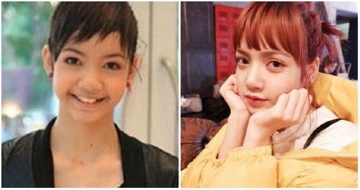 Lisa BlackPink Plastic Surgery : Before and After