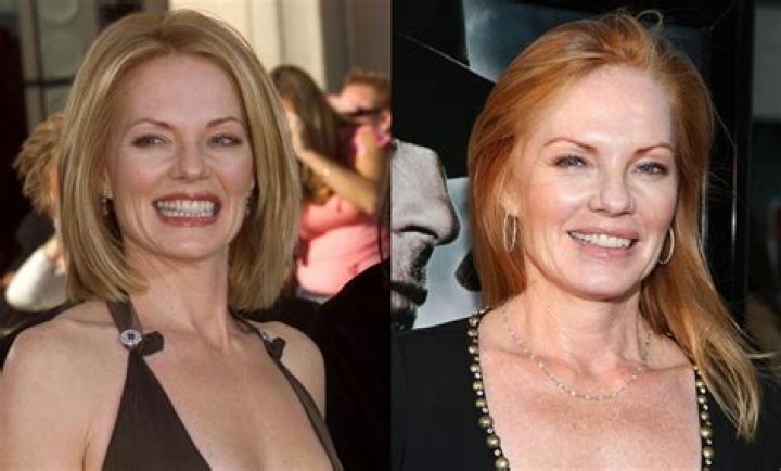 Marg Helgenberger Plastic Surgery: What's Really Behind the Online Speculation?