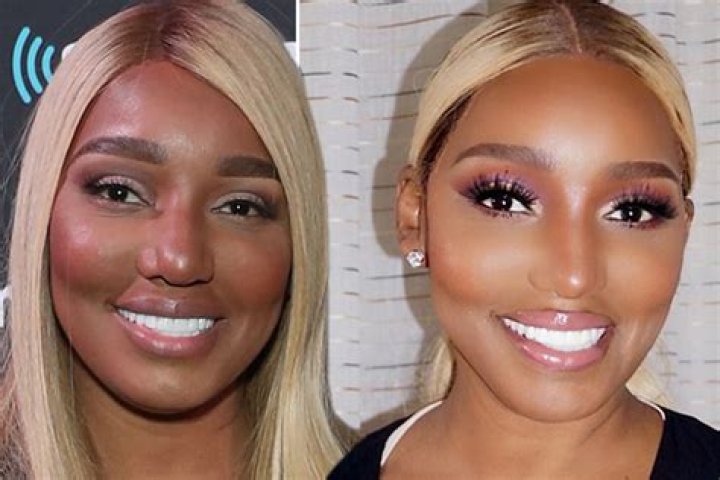 NeNe Leakes Opens Up About What Plastic Surgery She’d Still Get And What Procedures She Never Would!