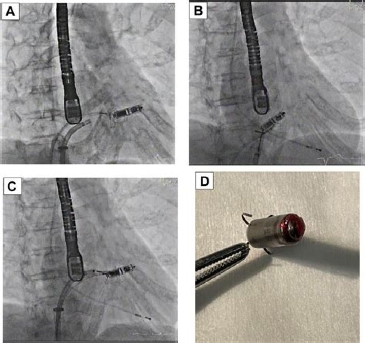 Dr. Robert Canby, MD – Austin, TX