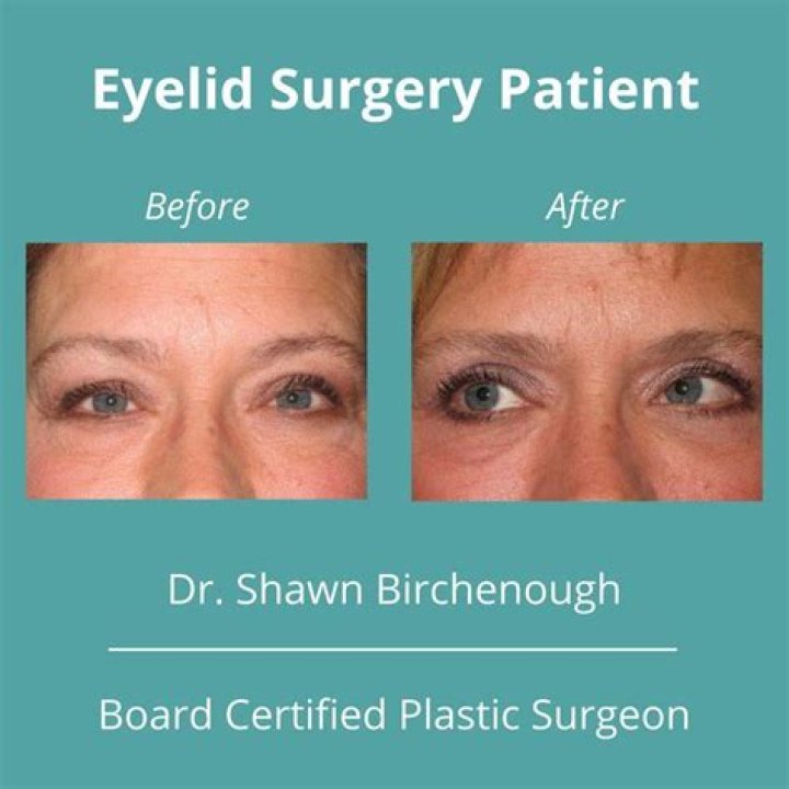 Dr. Shawn Birchenough, MD – Spartanburg, SC