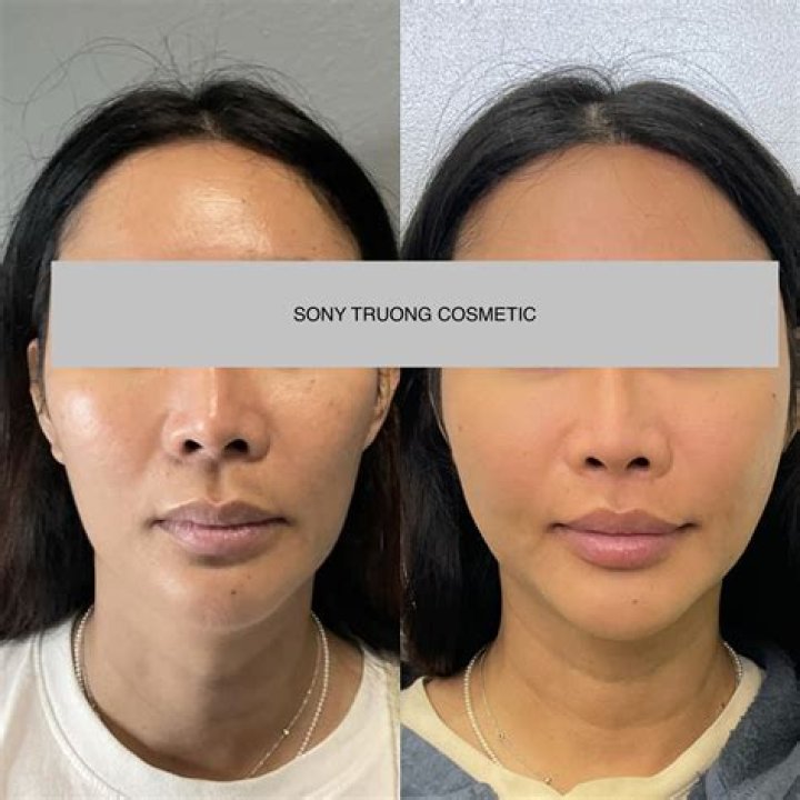 Dr. Sony Truong, MD – Westminster, CA