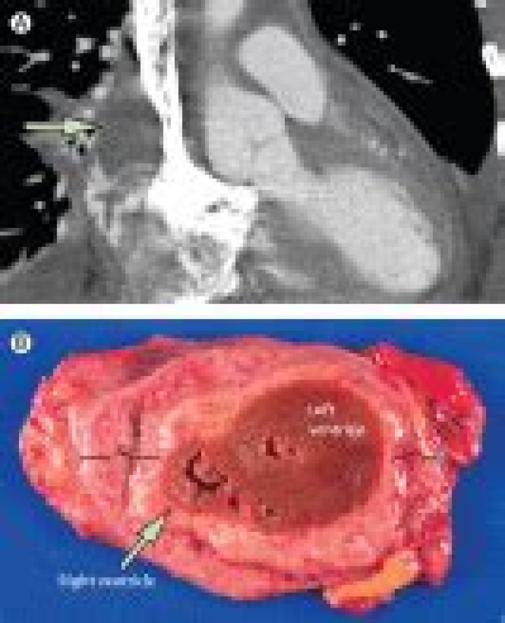 Dr. Tejo Musunuru, MD – Chesterfield, MO