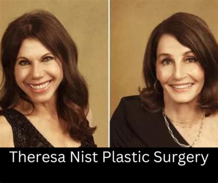 Theresa Nist Plastic Surgery: Reviewing Her Appearance from Several Points of View!