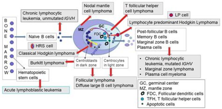 What disease does Lauren Graham have? Stage 4 acute lymphoblastic lymphoma explained