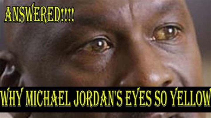Why Are Michael Jordan’S Eyes Yellow? – Celebrity